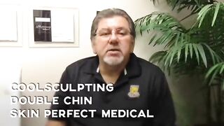 CoolSculpting Double Chin Testimonial Los Angeles