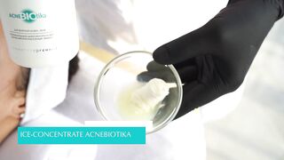 AcneBiotika процедура