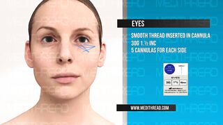 PDO-THREAD LIFT TUTORIAL BY MEDiTHREAD - EYES