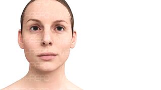 PDO-THREAD LIFT TUTORIAL BY MEDiTHREAD - BROW LIFT