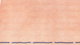 PDO-THREAD LIFT TUTORIAL BY MEDiTHREAD - BROW LIFT