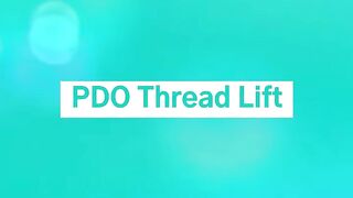 Z Lift PDO Thread Lift