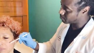 PDO Thread Lift Live procedure - Z-Lift
