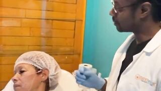 PDO Thread Lift Live procedure - Z-Lift
