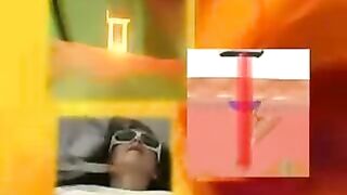 ZeddWellMD Laser Hair Removal