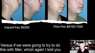 Chin Implant vs. Chin Surgery.  Make the Wise Decision!!!