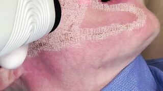 Laser Skin Resurfacing - Satisfying immediate results of your skin tightening, rejuvenate your skin!
