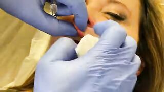 Wow! Lip Filler with Dr. Diepenbrock!!