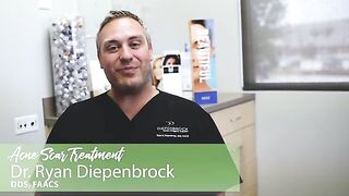 Acne Scar Treatment: what a facial cosmetic surgeon can do for you!