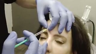 NewTox: All the things about injecting Botox®, Jeuveau®, & Dysport®!!