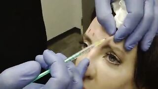 NewTox: All the things about injecting Botox®, Jeuveau®, & Dysport®!!