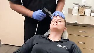 Morpheus8 Fort Wayne and Warsaw Indiana - Microneedling with Radio Frequency