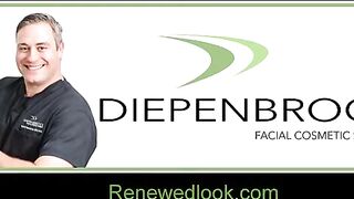 Rhinoplasty Scar revision with Ellman Radio Frequency by Cynosure