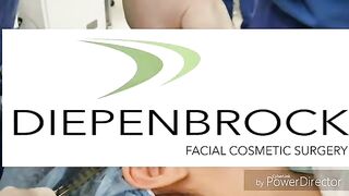 Skin Resurfacing with PRP, Microneedling,  and Laser for Acne Scars
