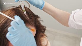 HAIR X PEPTIDE