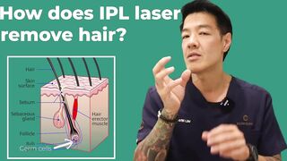 Everything about Laser Hair Removal at home | Dr Davin Lim