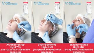 HighLYNX. Биоревитализация и реальное локальное омоложение тканей за счет таурина.