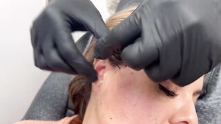 Thread Lift with Dr.Gideon Kwok│Skin Perfect Medical