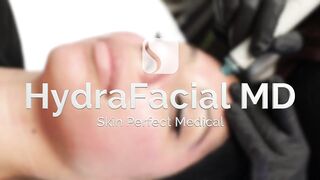 Is HydraFacial for you?