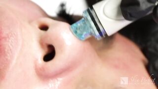 Is HydraFacial for you?