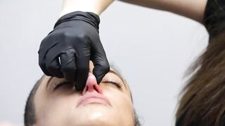 Fixing my Italian crooked nose - without surgery!